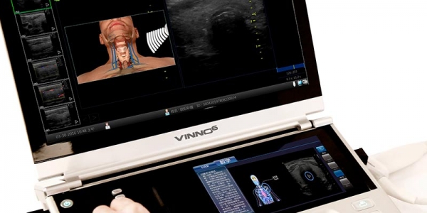 Ultrassom portátil Vinno 6 - SC Medical